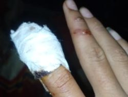 *Jari Siswa Hampir Putus Karena Kecelakaan Kerja di Sekolah, UPT SMP 10 Parsingguran Ogah Tanggung Jawab*