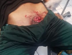 BREAKING NEWS: TRAGEDI DI KODIM JAYA WIJAYA, ISTRI BACOK SUAMI SENDIRI